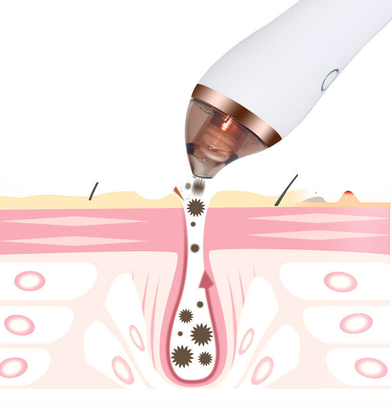 4 in 1 Body and Facial Cupping Blackhead Remover Machine
